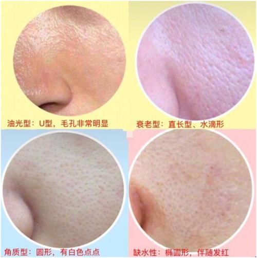 细腻无瑕的肌肤，怎能让毛孔毁了精致