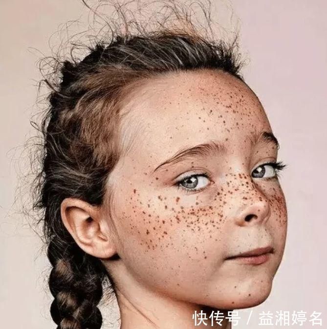 痘痘克星|这3水果被称“痘痘克星”,女生多吃能“战痘成功”,牛奶肌“找上门”