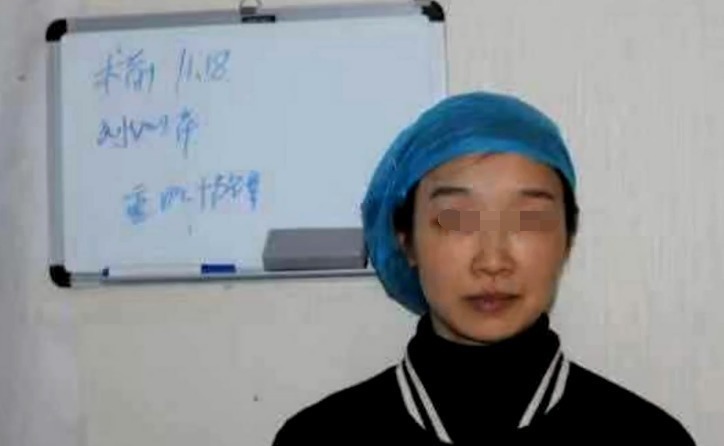 刘女士 花5万多做耳软骨隆鼻,女子术后竟不敢抬头!院方送你个双眼皮