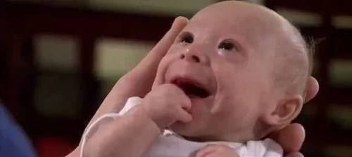 侏儒症|婴儿刚出生就被判侏儒症停止发育,父母不愿放弃如今变成这样!