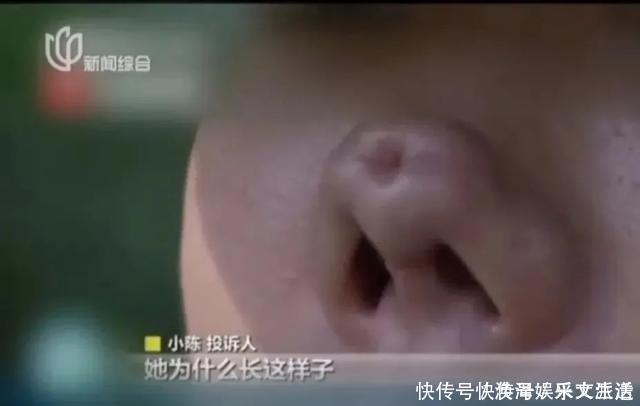 初恋这件小事|女明星注射面部逐渐“馒化”,要不要去整容?先问问她们再说吧!