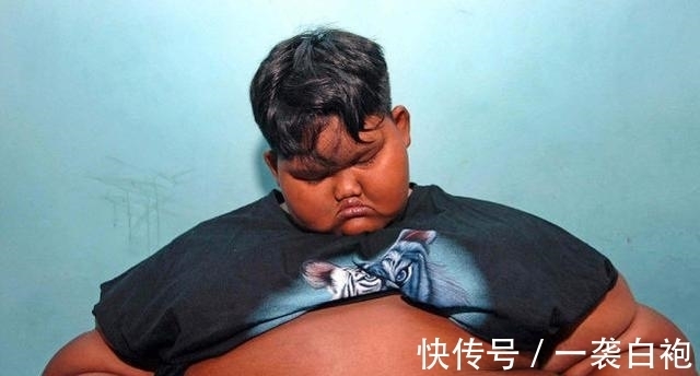 体重|曾经那个世界最胖的男孩！体重384斤，减肥152斤后变帅小伙