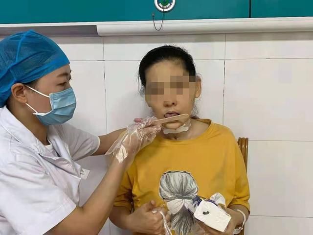 吞咽困难|32岁女子脑积水术后五年不能吞咽，20天精准康复再次尝到食物味道