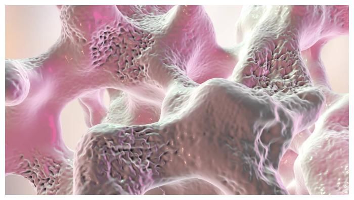 骨质|骨质疏松不能吃黄豆?专家忠告:不想加快骨质丢失,2黄尽量少吃