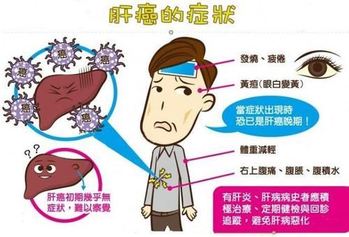  当回事|身体出现这几个表现，可能肝硬化正在发生癌变，别不当回事！