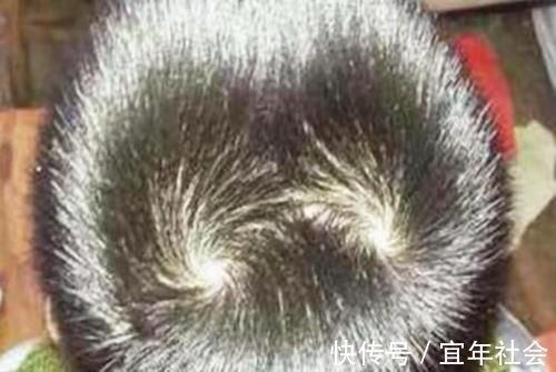 孩子|“两个旋”的孩子更聪明?关于“头旋”个数,有两件事情要知道