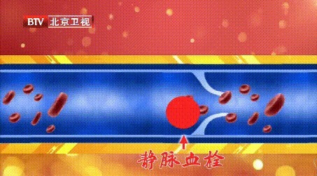 睡眠时间|每天吃一把它,一觉睡到大天亮,中老年适合