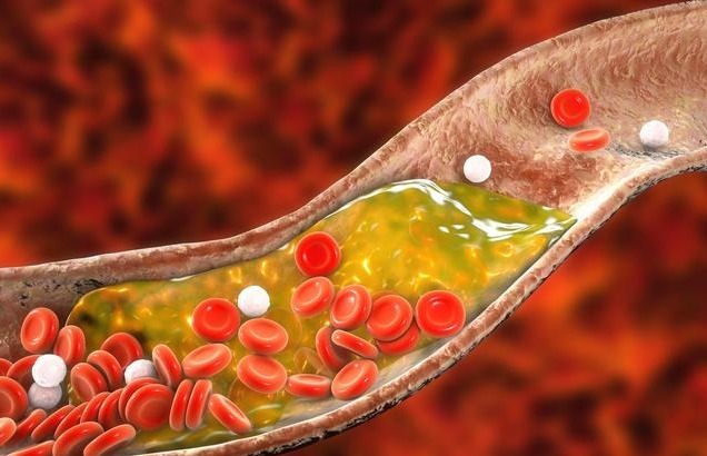 胆固醇|三类食物,堪称“降脂高手”,经常端上饭桌,血液更“清澈”