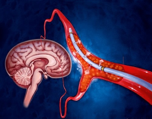比糖和盐更“可怕”的调味剂,怪不得三高、肥胖找上