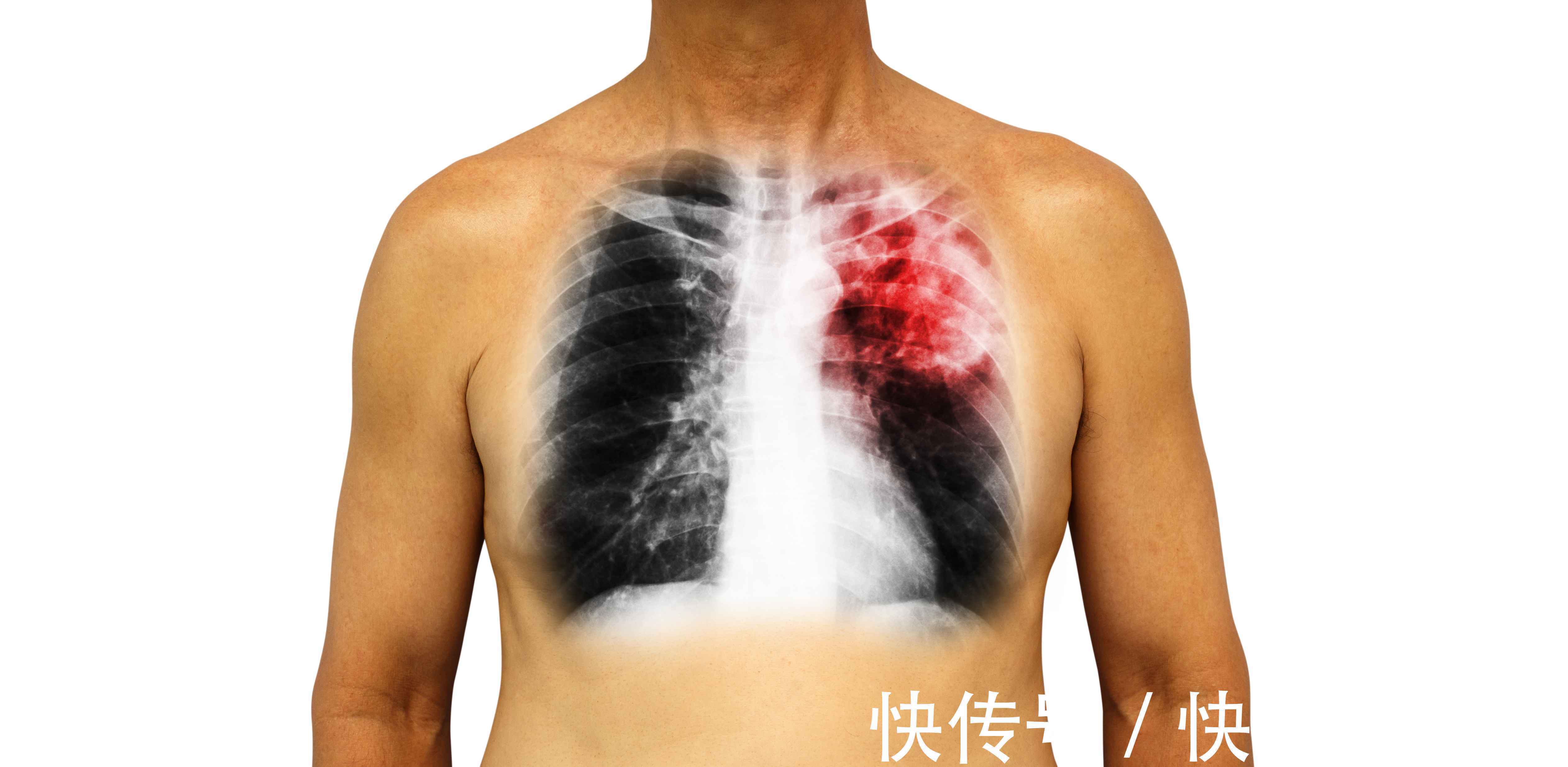 花生|吃花生能养生?每天坚持吃几粒,身体或可收获6个“惊喜”