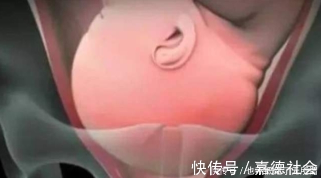 全程|女性顺产“开十指”有多宽?镜头直击全程,赞叹母爱之伟大!