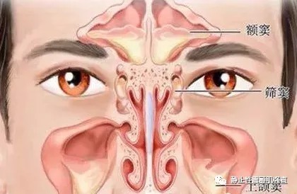 九窍|补脾,是一切疾病治疗的关键,生津润燥汤治疗干燥综合征就是如此