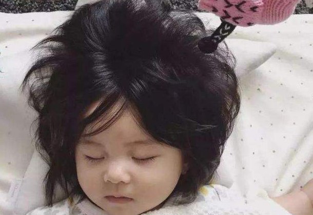 宝宝|宝宝头发竖着长代表发育好？错！遇上这几种情况可能身体亮了红灯