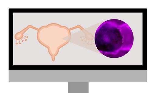 女性没了子宫会怎么样身体发生的变化,多数女性或难以接受