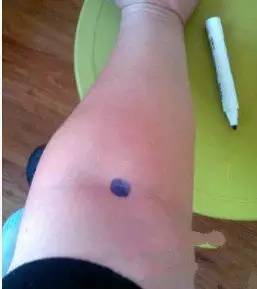 穴位|人体上居然还有“一键关机、一键清理”穴位,收藏以备不时之需!