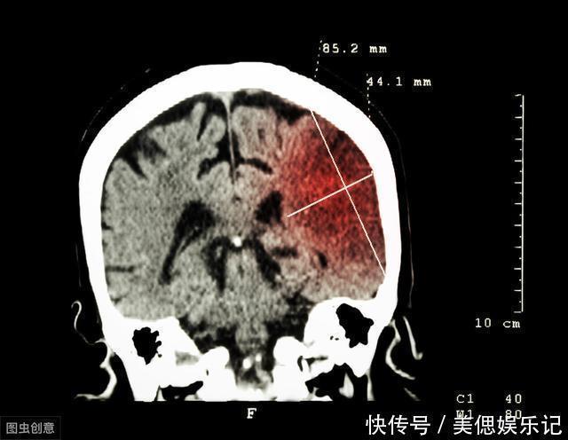 血管|不论男女，睡前养成1个好习惯，血液干净血管不堵，人长寿