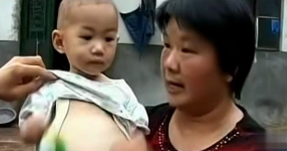 肚子|一岁半女婴意外“怀孕”,体内被查出死胎,手术途中吓坏医生