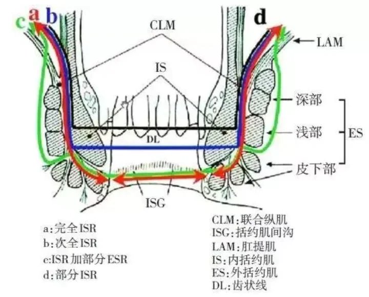 肛门|日照市人民医院新技术造福结直肠肿瘤患者