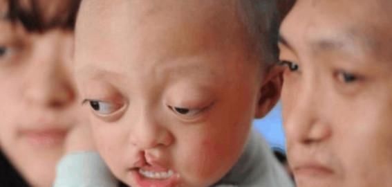 先天|夫妻先天缺陷坚持生孩子, 生下的孩子遗传了家族所有缺陷