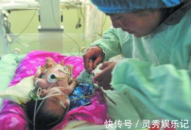 nt|孕妇出现三个“特点”,胎宝宝可能智力有问题,孕妈要多留意