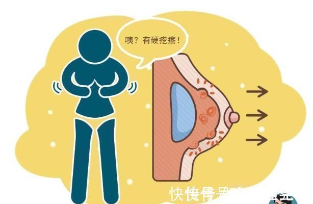 癌症|女性乳腺癌发作前，身体会发出这6种异常信号，越早发现越好