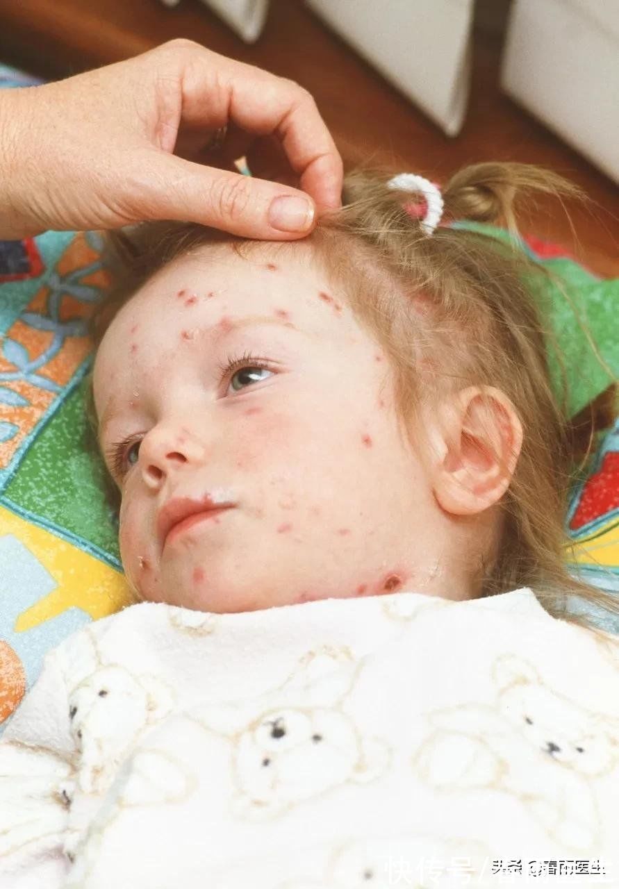 呼吸道|秋冬气温降低，一定要注意防范这几种疾病