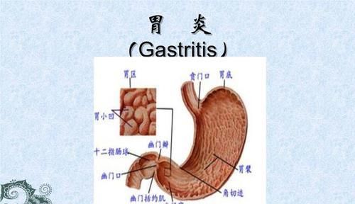 饭后打嗝真的是吃饱的表现吗，4个原因会导致打嗝，第4个最常见