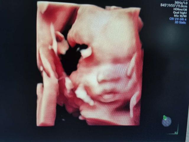 检查|四维彩超什么时候做4项准备孕妈提前做好,检查才会更顺利