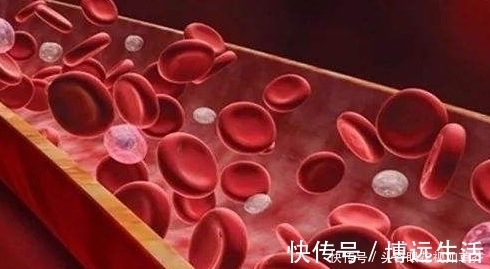 天敌|血栓天敌被发现了,每天吃2口,清血管冲走血栓,杜绝高血脂