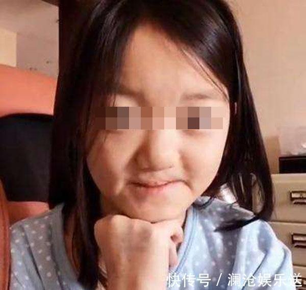 胎儿|医生三类孕妇容易生“兔唇”宝宝,如果你在其中,就要小心了