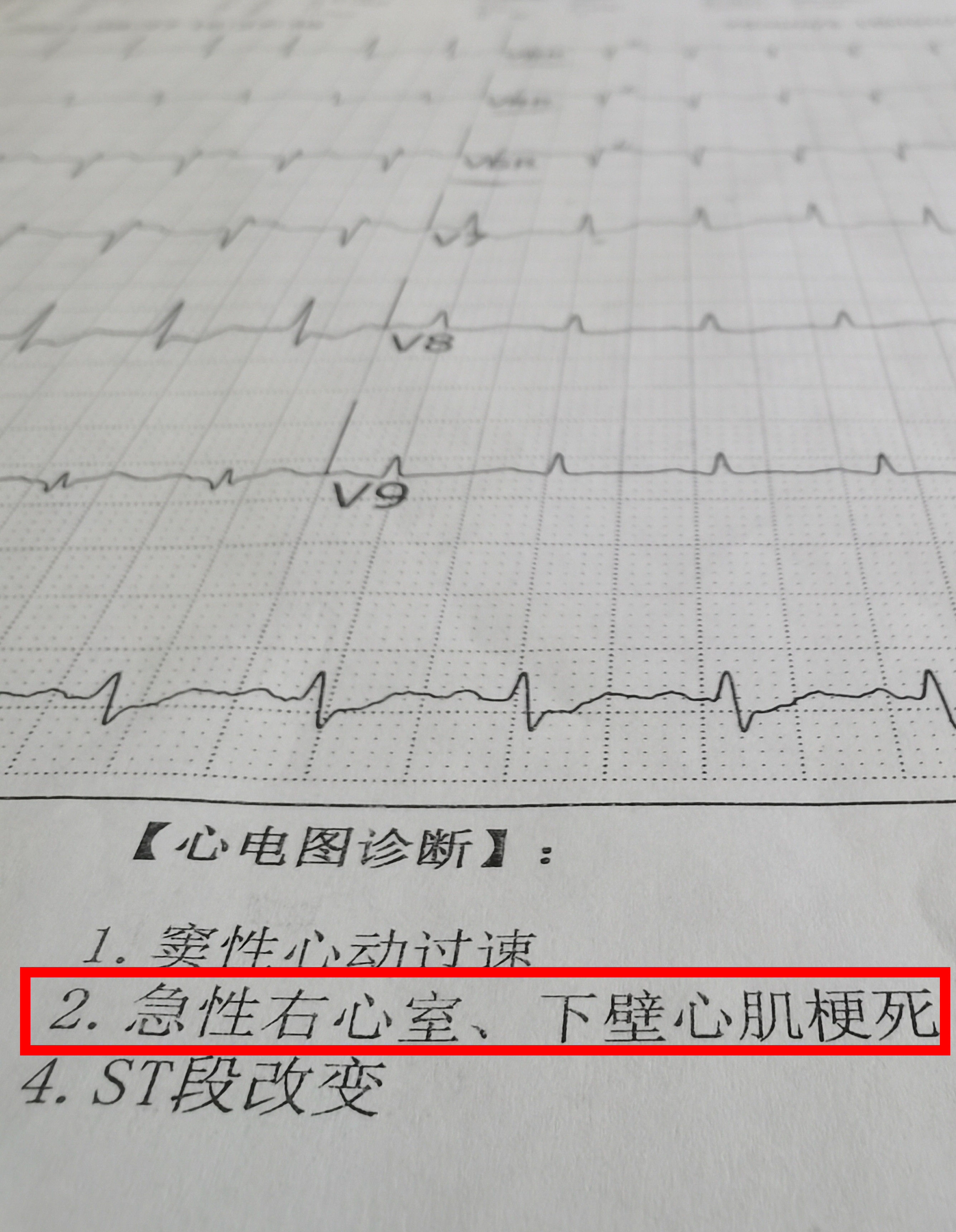 酒龄|20年烟酒沉醉，耗尽36岁的年轻生命