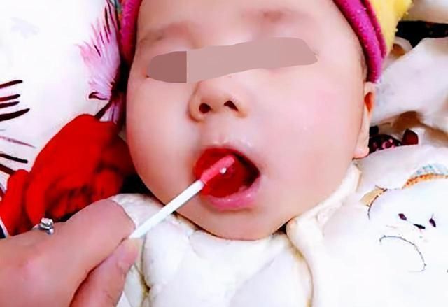 食物过敏|五个月女婴双肾长满结石,只因刚出生三天,父母就开始做这件事