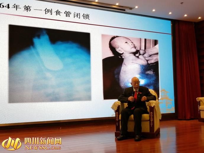 联体|华西医院小儿外科成立60周年了 10年前获救联体女婴到场共同庆祝