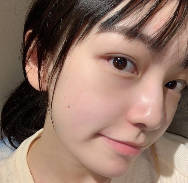 女生长痘痘,记住3句话,痘痘不敢来犯,做男神“收割机”