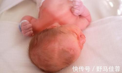 前囟门|囟门被称为宝宝的“命门”,若出现这几种形态,别耽搁赶紧去医院