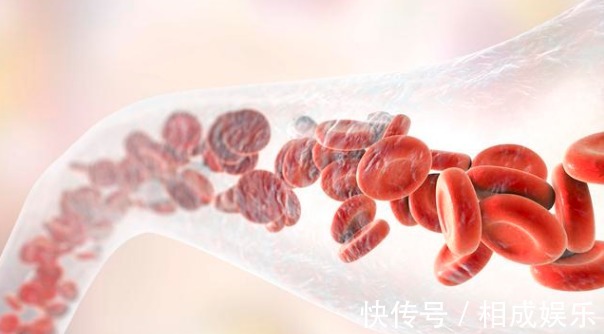 血脂|身体出现4种表现,建议赶紧去查血脂,早发现早治疗