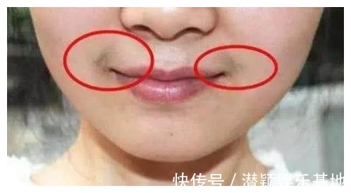 自测|女人有没有妇科病，看嘴巴或许就知道，对照自测，希望你一个没有