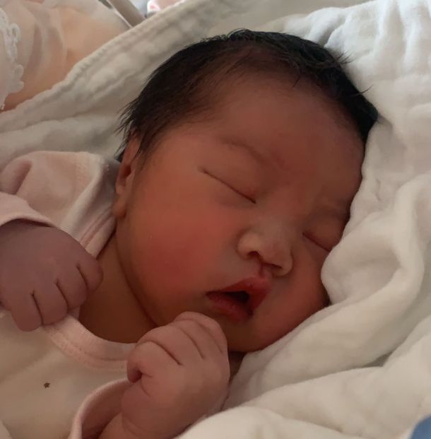 尿不湿|尿布疹出现,尿不湿要背锅?新手妈妈太粗略了