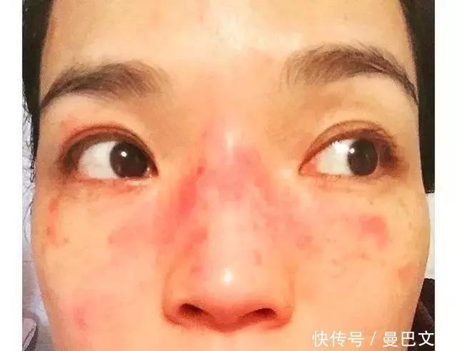 角质层|为何建议女生别“天天敷面膜”,这3个原因你得知道,不敢敷了