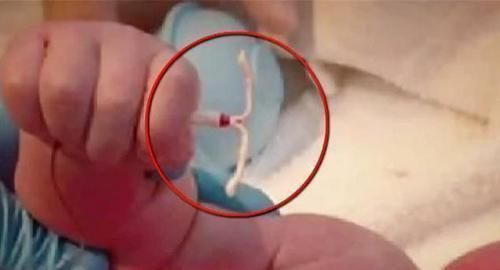 怀孕|新生宝宝“顺手牵环”,手握避孕环霸气出生,网友:此娃必成大器