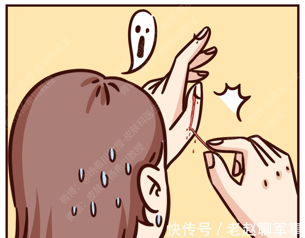 流血|变丑警告!6个毁皮肤的动作,你可能每天都在做!