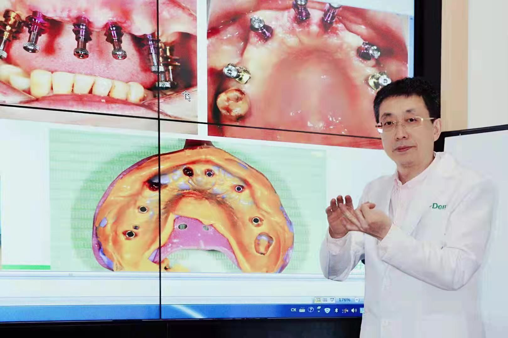 牙齿|人生长跑拼健康，口腔专家：一口好牙定输赢