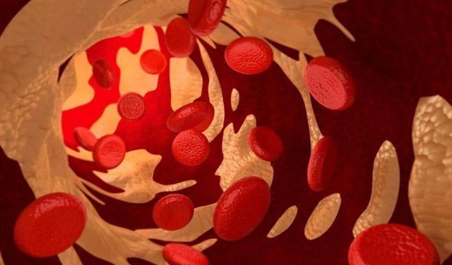 四川大学|四川大学首次公布：血脂“畏惧”2种食物，经常吃些，血管更畅通