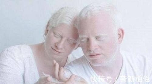 元气满满|“妈妈,我怕光”,姐妹俩出生全身雪白,网友:父母太不负责任