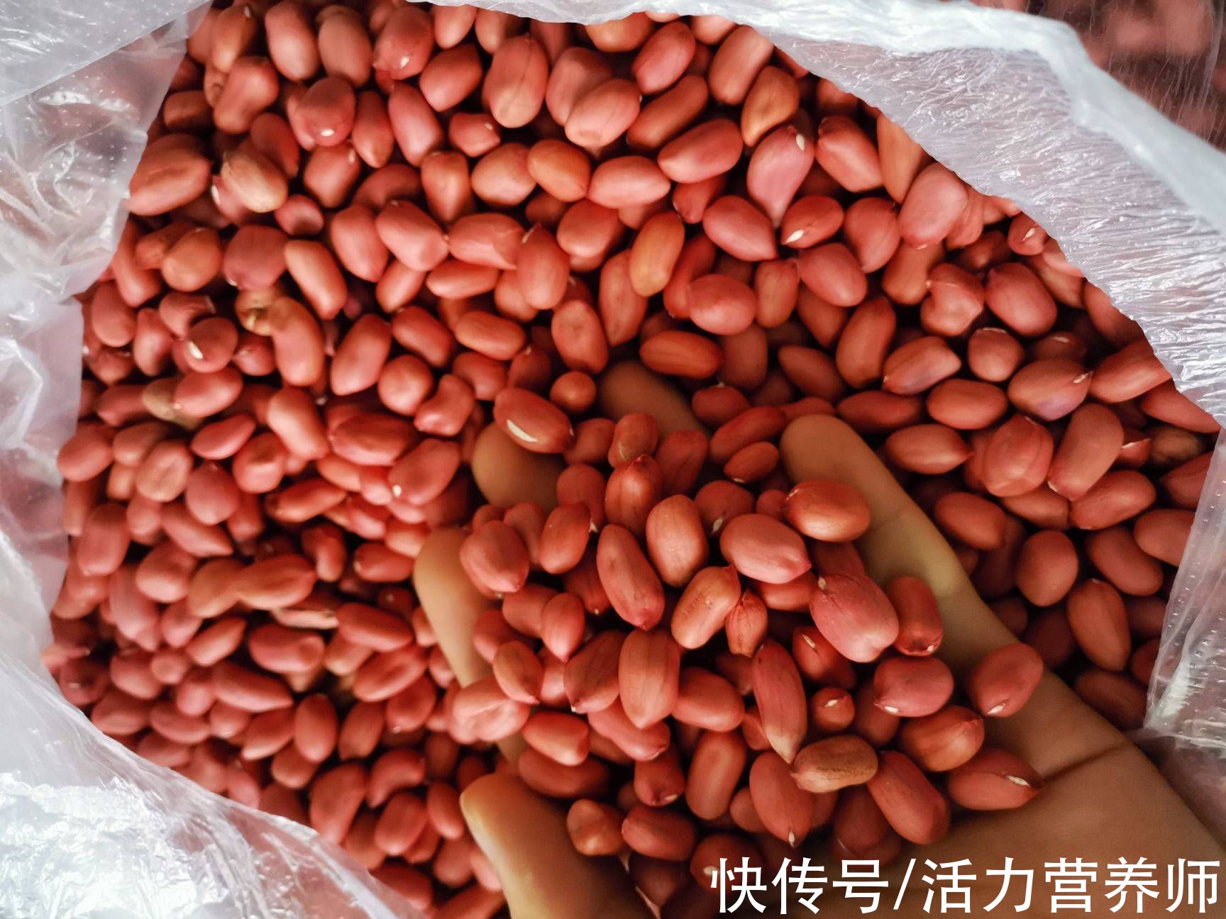 皮膚瘙癢|花生中的脂肪，是“萬惡之源”還是“養生佳品”？給三高人的建議