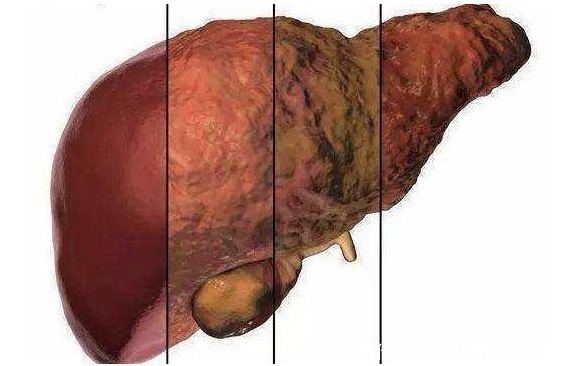 肝损伤|“肝毒”太深，“脸上”有3种表现，排除肝毒，按一穴、吃三蔬