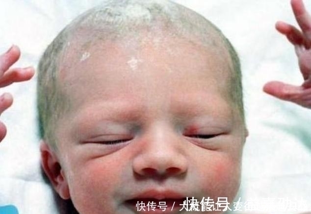 唇线|孩子“新生丑”家长莫担心,脸上有这4条线,坐等颜值逆袭!