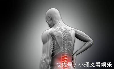 坐骨|厉害了!大蒜配它,解除了3年神经压迫坐骨痛,腰间盘突出拜拜!