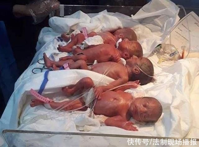 马里|马里女子产下9胞胎一个月全部存活，破世界纪录