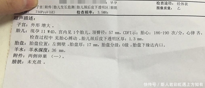 孕妇|确定怀孕后,第一次产检是在什么时候?超过这个时间,就晚了